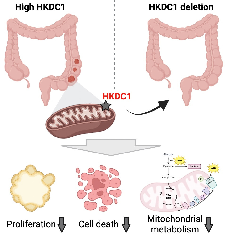 HKDC1 and its role in intestinal inflammation and carcinogenesis